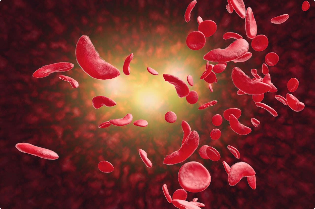 A photo of blood cell in abnormal shape flowing