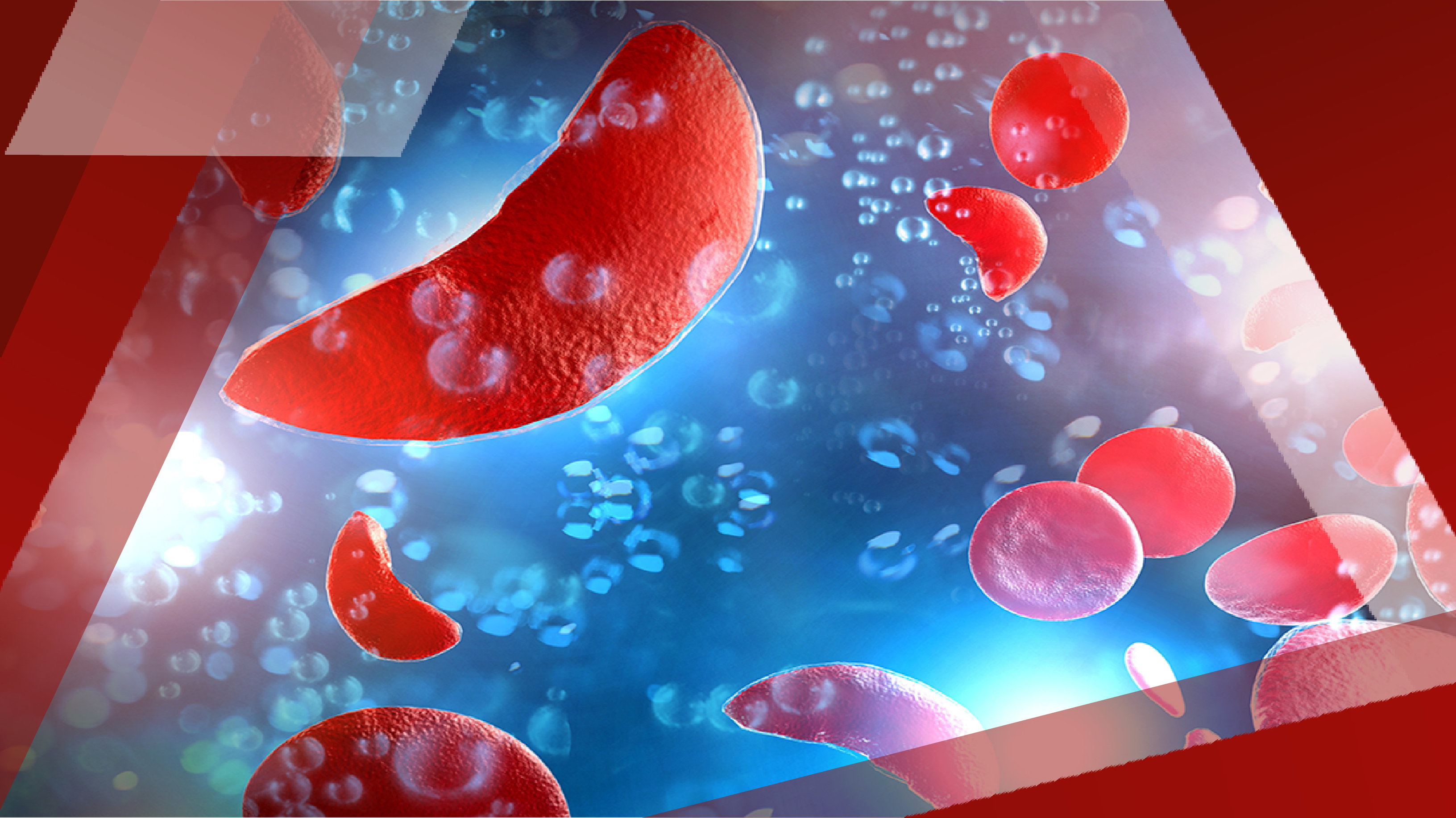 Advancing_Sickle_Cell_Card