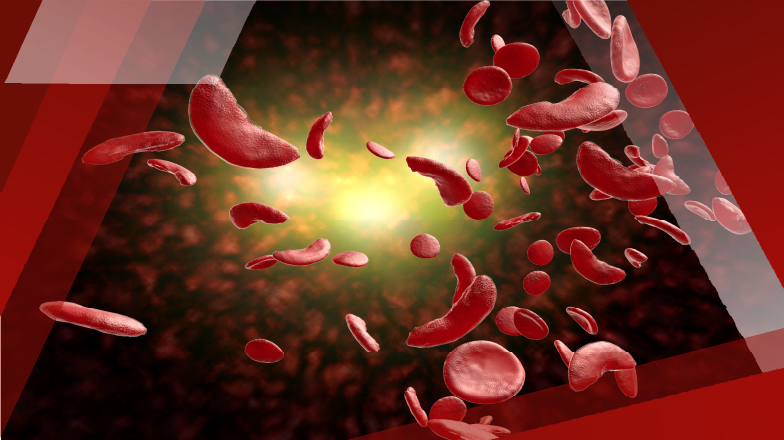 SCD_Workshop_783x440_1@72x-100