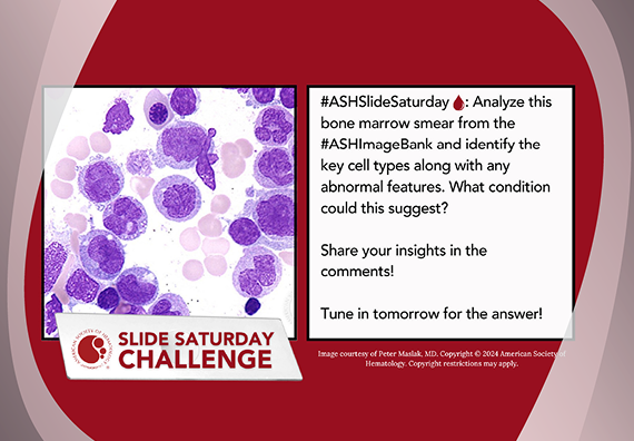 Sample of a #SlideSaturday post