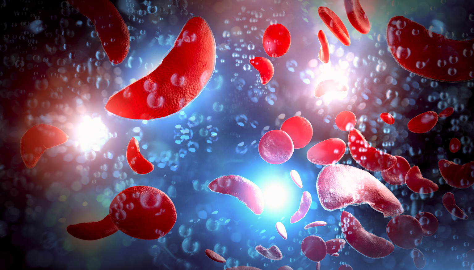 Image of abnormal red blood cells flowing
