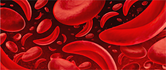 Sickle Cells Banner