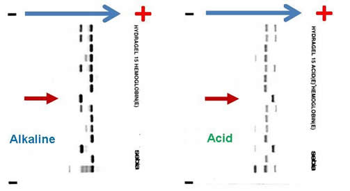 case study on sickle cell anemia class 12