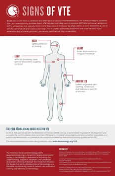 Signs of VTE