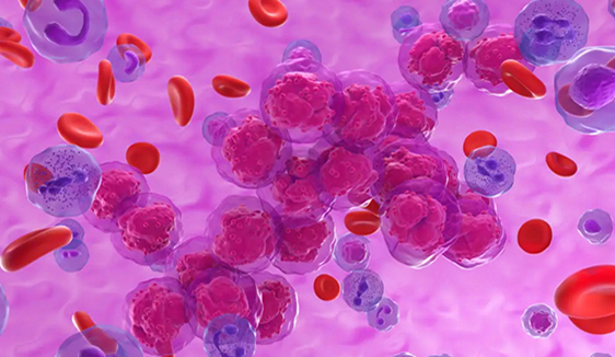 Leukemia_Blood_Cell_562x326