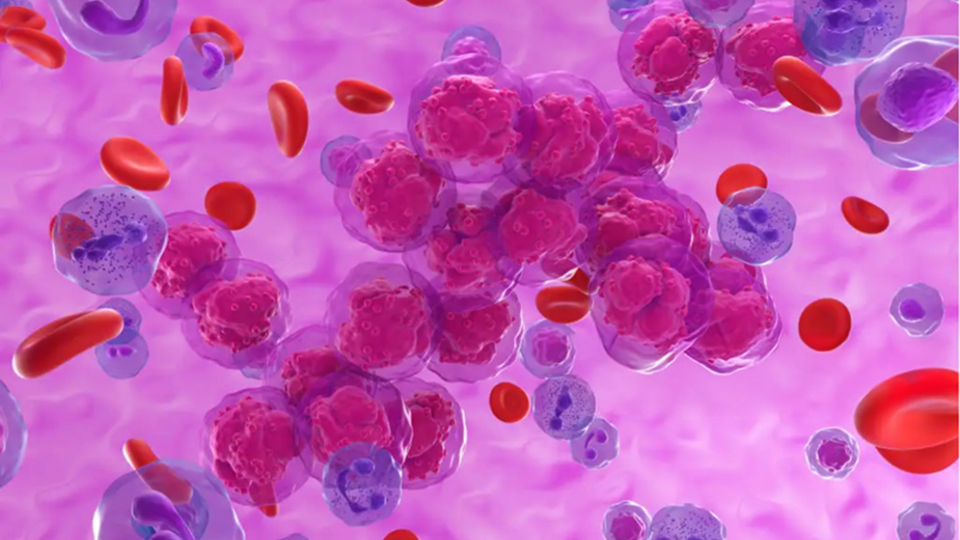 A photo illustration of red blood cells and floating red balls depicting acute lymphoblastic leukemia