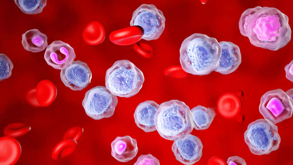 A photo of red blood cells floating with blue and pink balls depicting myeloid leukemia