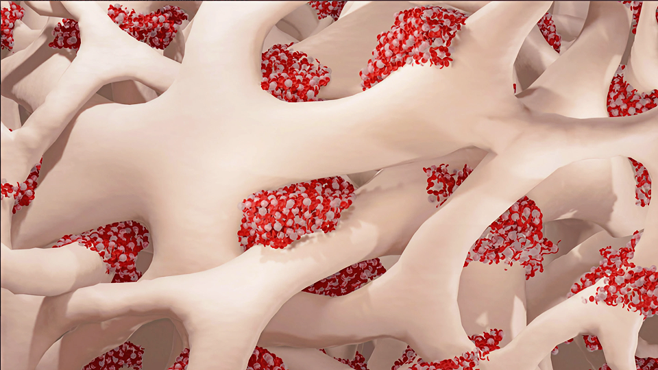 A photo illustration of 3D bone marrow intricately woven together.