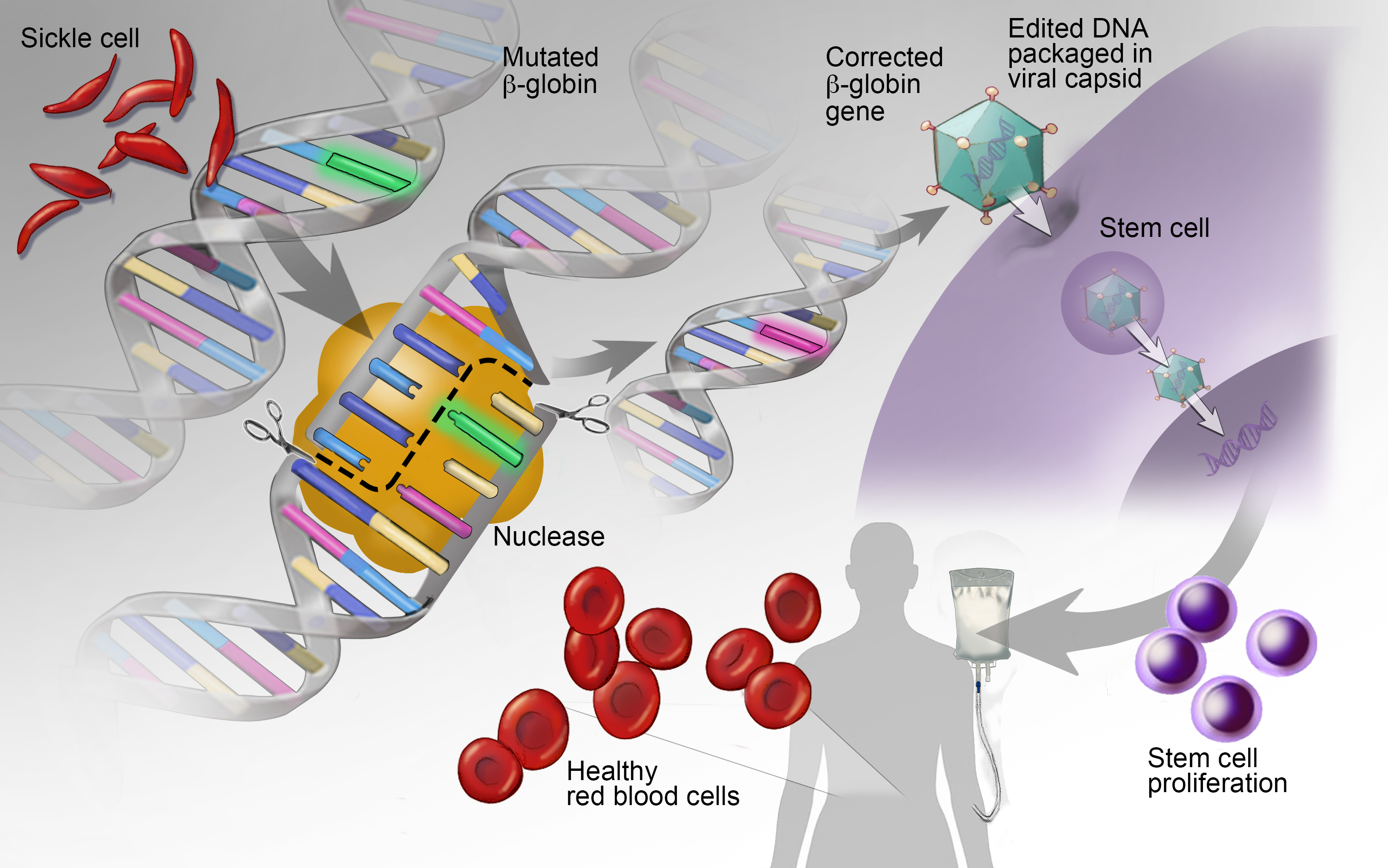 case study about gene therapy